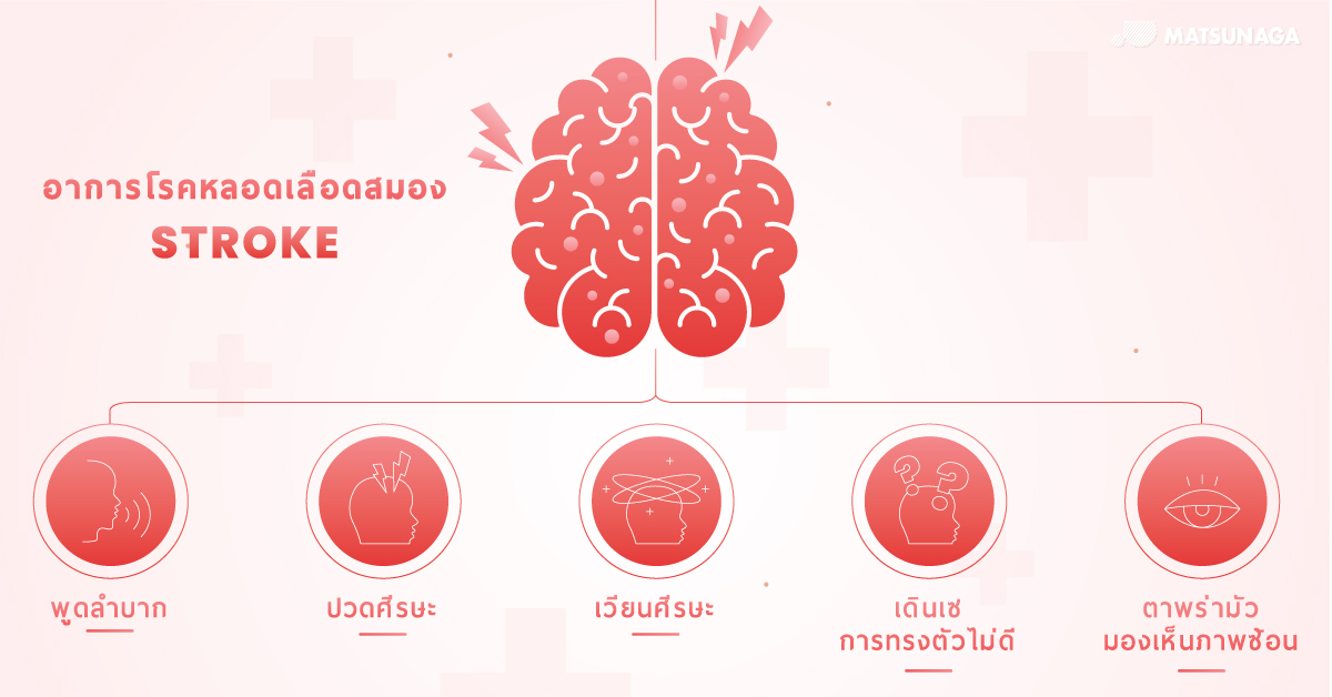 อาการโรคหลอดเลือดสมอง Stroke