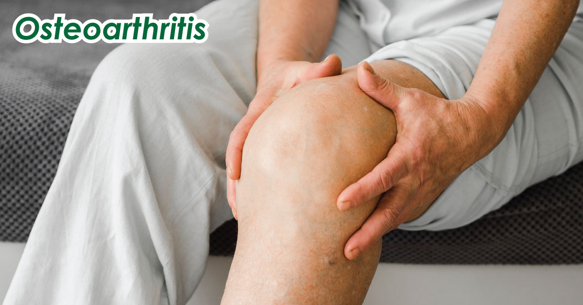 Osteoarthritis